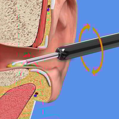 Smart Ear Wax Remover with HD Camera & LED Lights