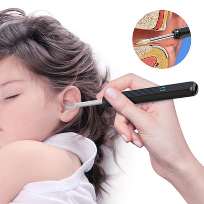 Smart Ear Wax Remover with HD Camera & LED Lights